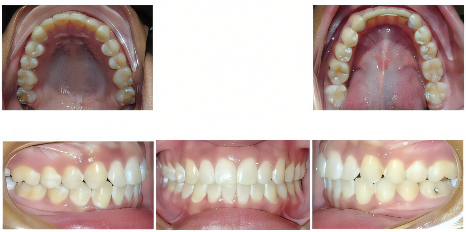 Comprehensive treatment after